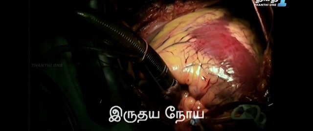Moviesda.Mobi - Mistake 2024 Original 720p HD.mp4